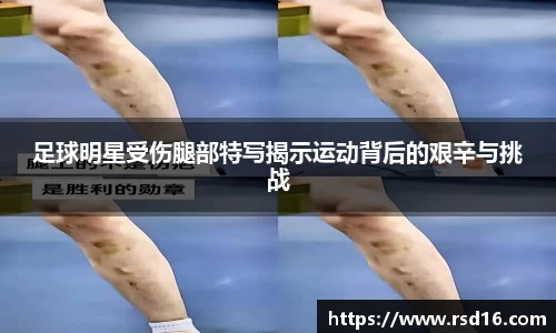 足球明星受伤腿部特写揭示运动背后的艰辛与挑战